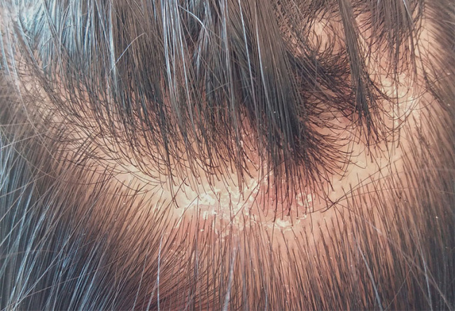kiểu tóc, top 13 nguyên nhân gây ra rụng tóc