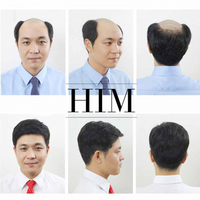 kiểu tóc, top 5 địa chỉ bán tóc giả nam cao cấp ở tp.hcm